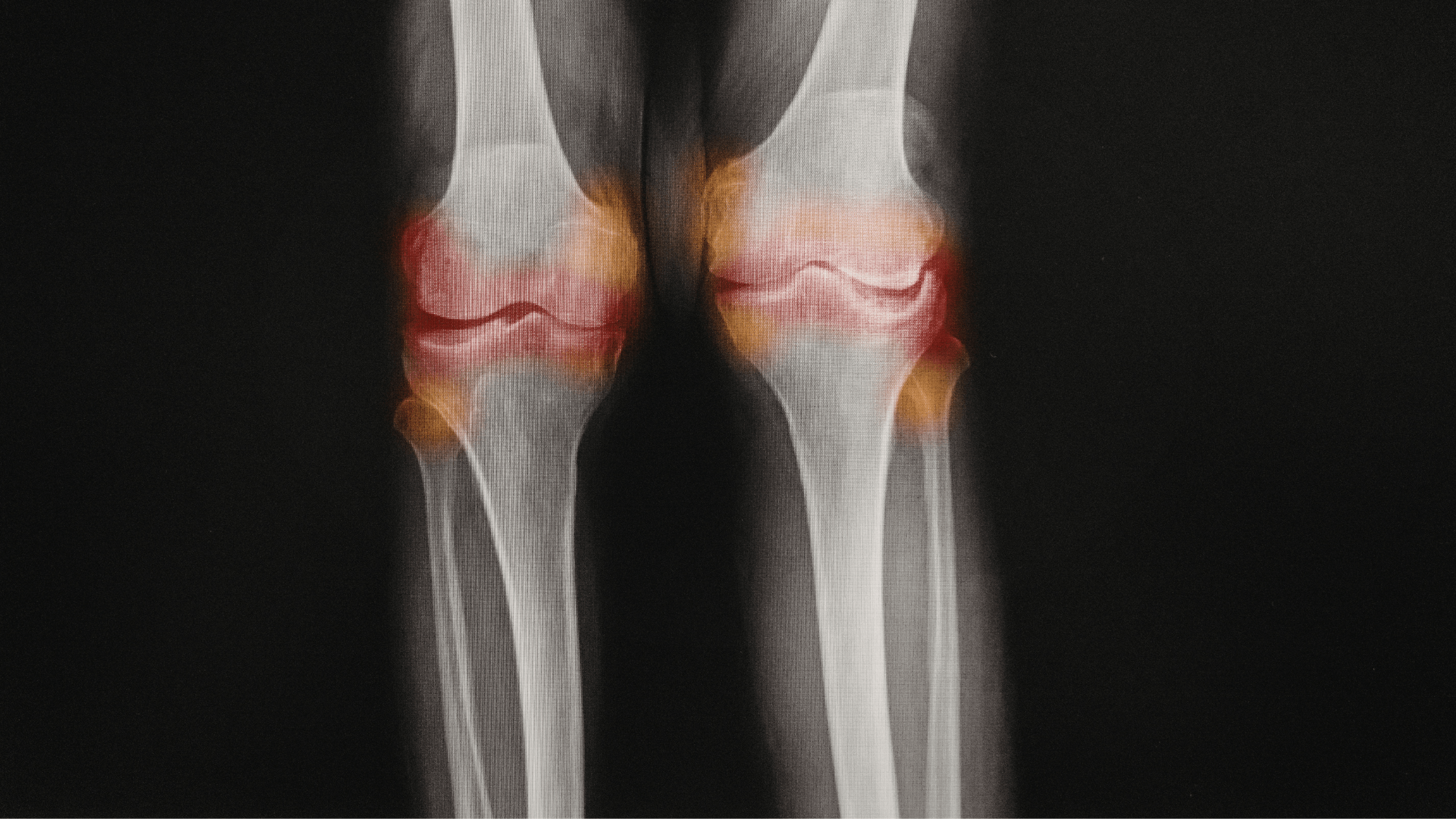 Common sources of chronic spine and joint pain being evaluated by a specialist.
